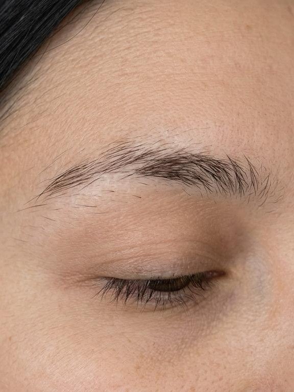 Antes — Micropigmentação Fio a Fio