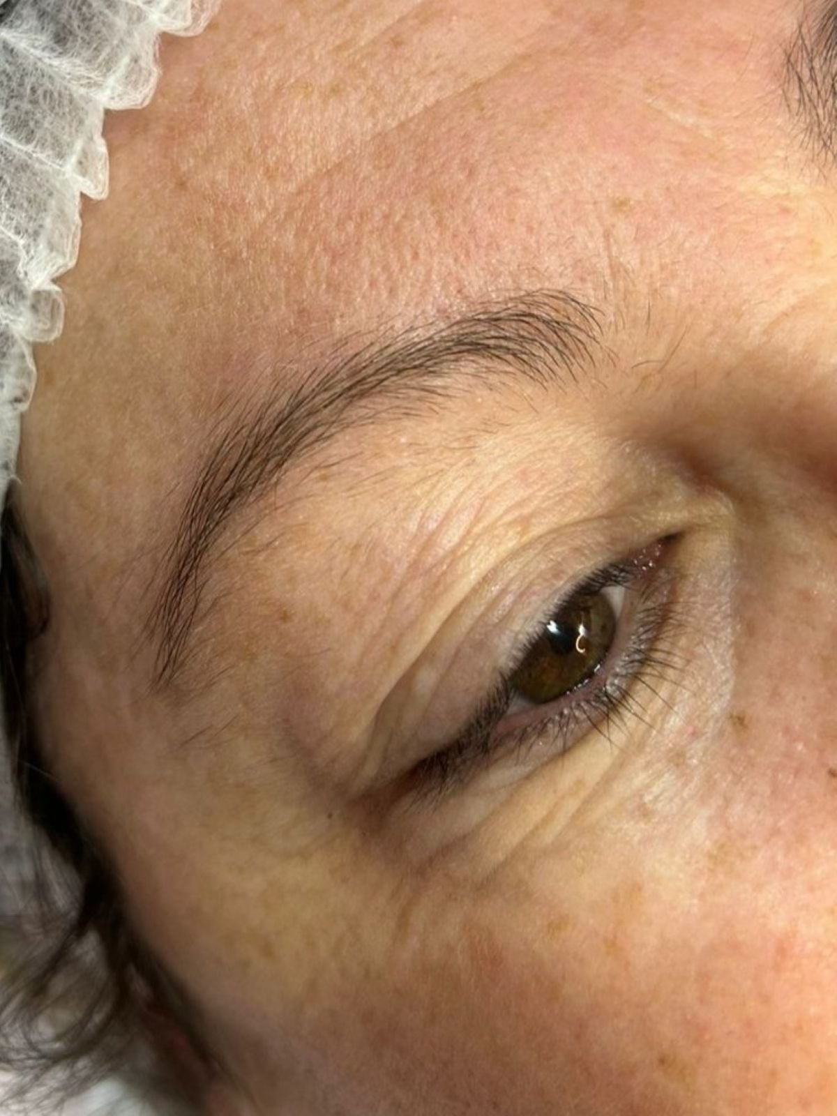 Antes — Micropigmentação 2